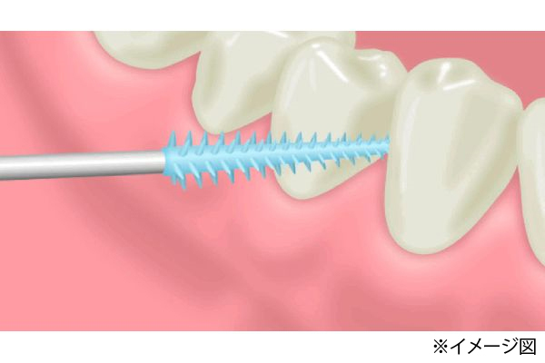 ［サンスター］ソルテージIIソフトピック
