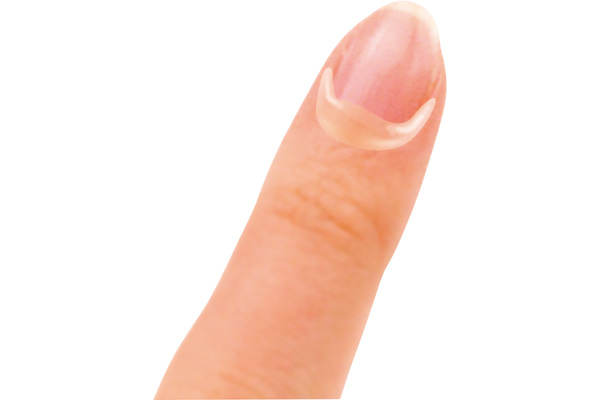 消毒もできる液体ばんそうこう