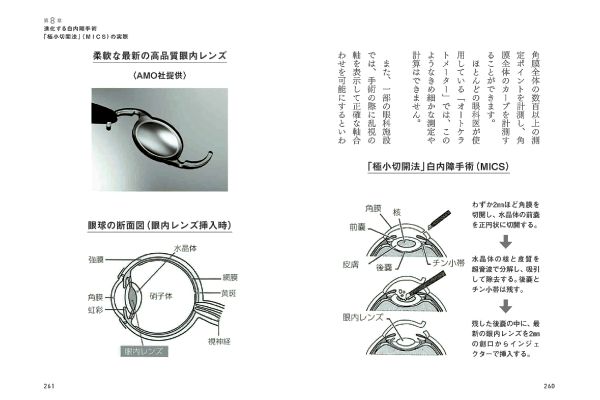 白内障手術で後悔しないために知っておきたい本当のこと